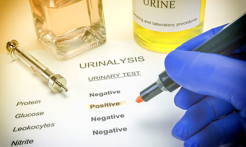 Urine tests can detect use of methylphenidate for approximately 1 to 3 days.